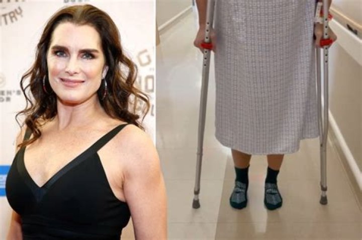 Brooke Shields broke her femur and had to relearn how to walk