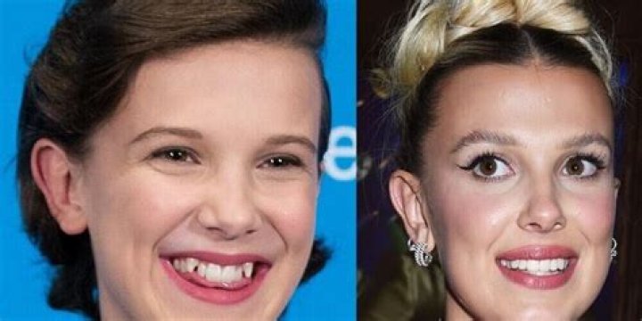 Gabriel Macht's Enigmatic Lip Scar: Mouth Cancer Rumors