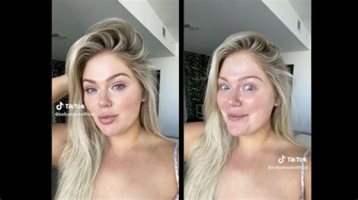 Gemma Owen | Plastic Surgery Trending On Tiktok: Before