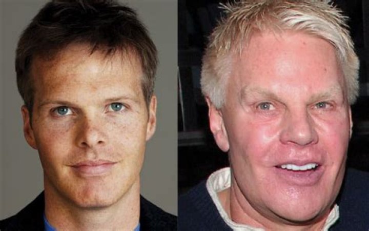 
Has Mike Jeffries had surgery to change his looks 