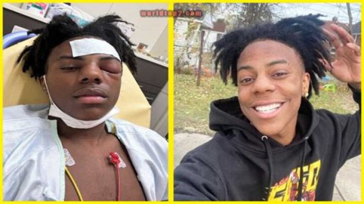 IShowSpeed Bio (Wiki) 