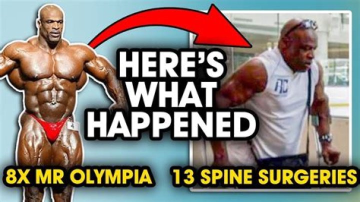 
Jonathan Pearce Injury & Surgery- What Happened To Him? 