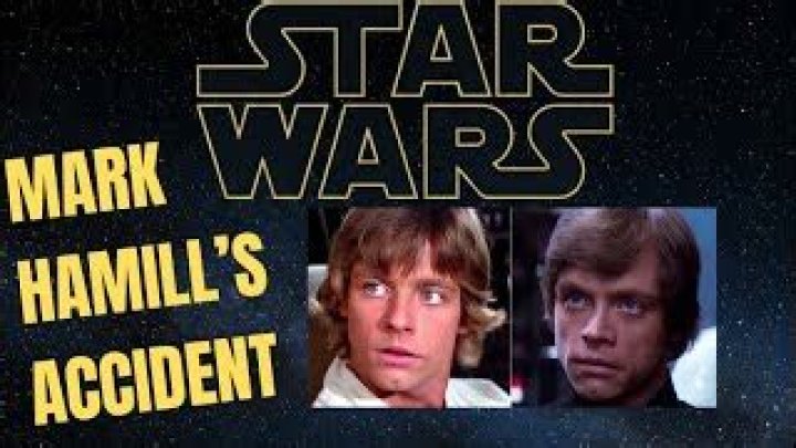 Mark Hamill Face Scars And Accident Update: What Happened To Him?
