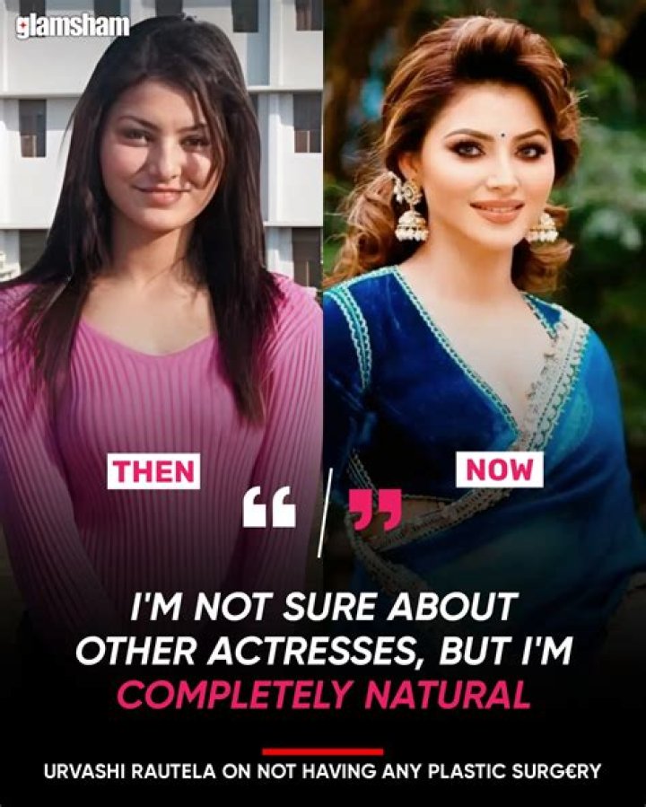 Urvashi Rautela Plastic Surgery Before And After: No Makeup Look Viral On Tiktok