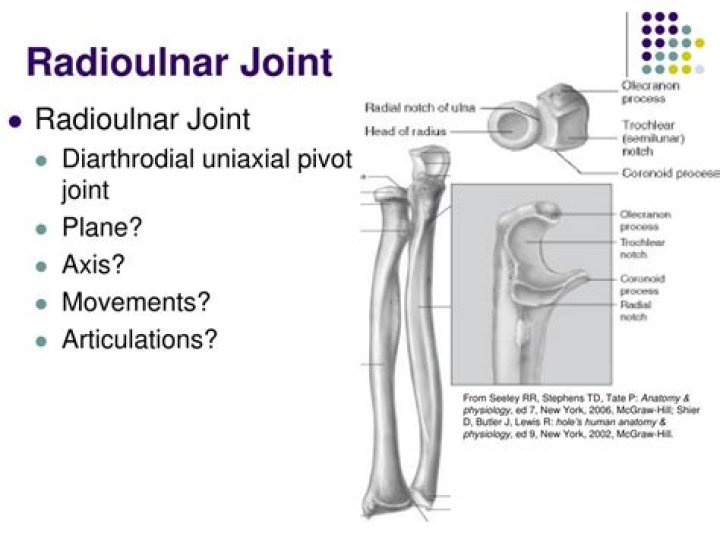 What type of joints are the proximal and distal radioulnar joints?
