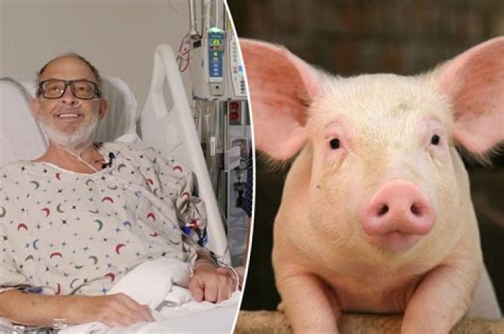 
Who Was David Bennett? Know About The Man Who Got Pig Heart Transplant 